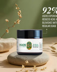 Anti Acne Cream with Herbal Actives for Clear Skin - Nature4Nature