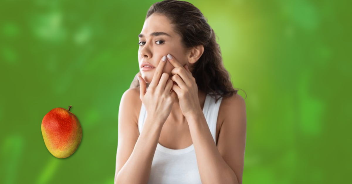 Myth vs Fact Does Mango cause Acne?
