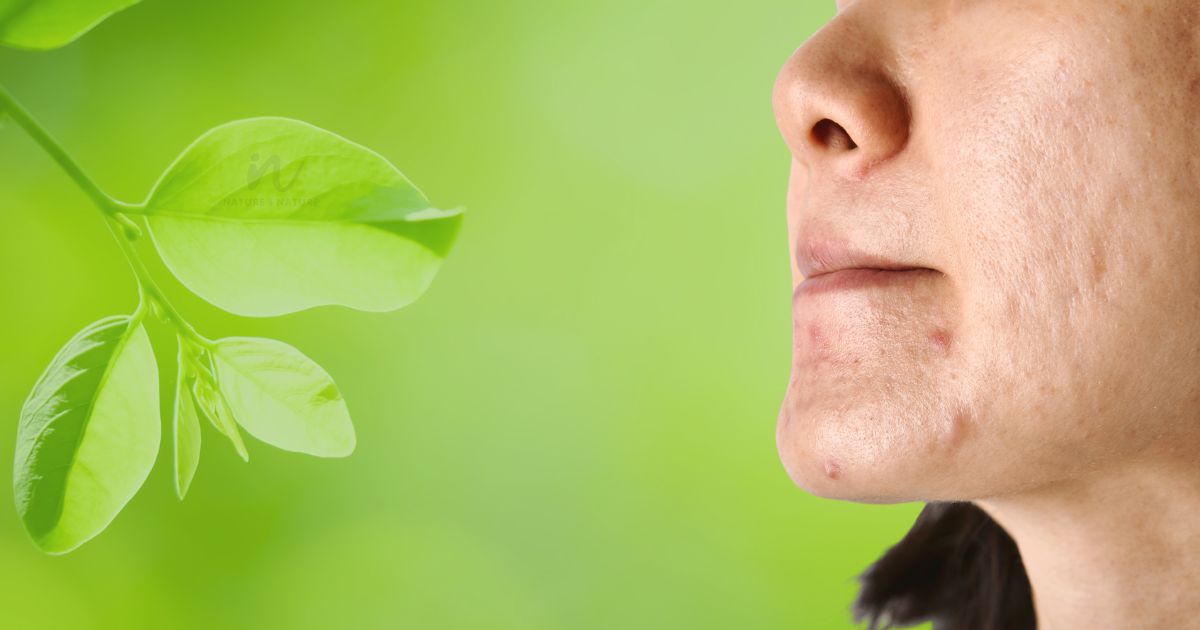 How to repair damaged skin on the face naturally