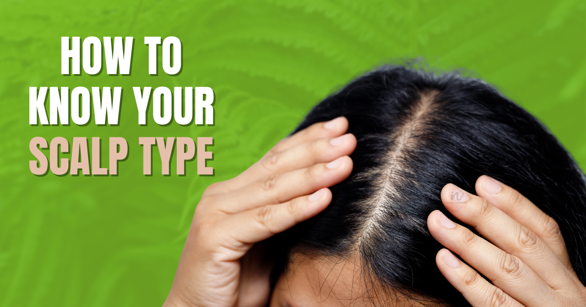 How to know your scalp type? Read it to find out now!